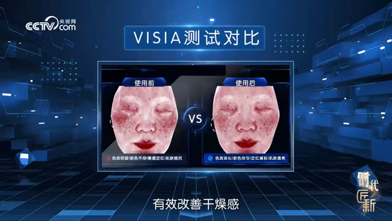 揭秘宝宝护肤安心之选：如何用精简配方，兼顾功效与肤感？